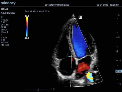 Аппарат ультразвуковой диагностический DC-40 - 388 500 руб.