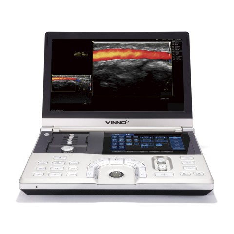 Портативный УЗИ сканер VINNO 5 - 724 500 руб.