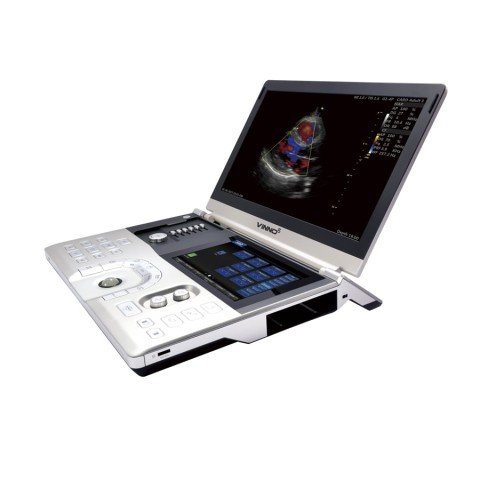 Портативный УЗИ сканер VINNO 5 - 724 500 руб.