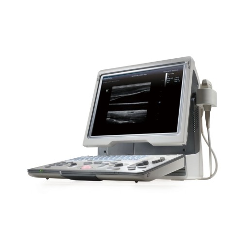УЗИ аппарат Mindray DP-50 Color - 351 600 руб.